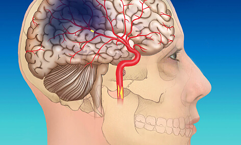 BOARD CERTIFIED MEDICAL ILLUSTRATOR (CMI)